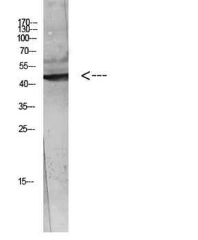 WISP-3 rabbit pAb Antibody