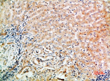 WISP-3 rabbit pAb Antibody