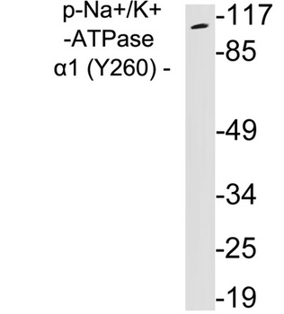 Sodium Potassium ATPase alpha-1 (Phospho-Tyr260) Rabbit pAb Antibody