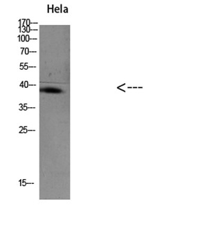 TIM-1 rabbit pAb Antibody