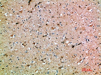 OSM rabbit pAb Antibody