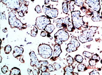 GH rabbit pAb Antibody