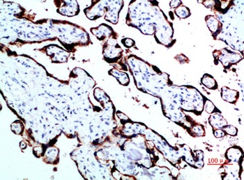 GH rabbit pAb Antibody