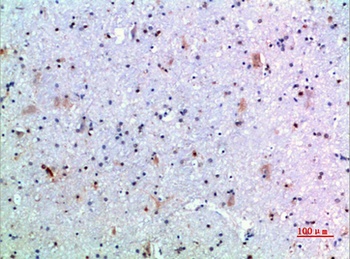 GH rabbit pAb Antibody