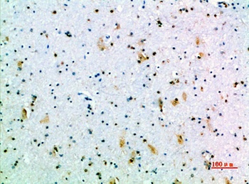 GH rabbit pAb Antibody