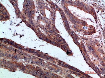 IL-1F7 rabbit pAb Antibody
