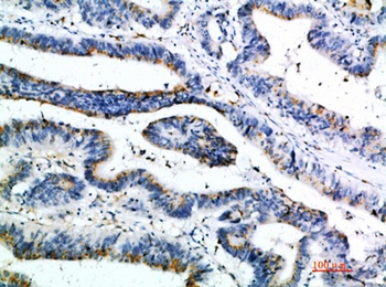 6CKine rabbit pAb Antibody