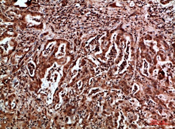HDGF rabbit pAb Antibody