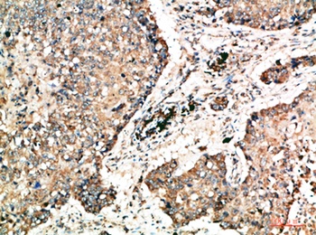 Napsin A rabbit pAb Antibody