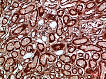 Napsin A rabbit pAb Antibody