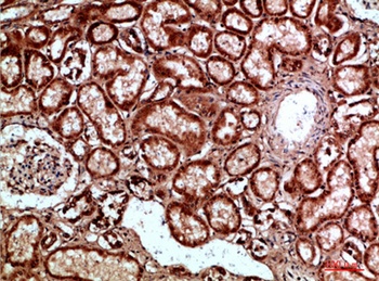 Napsin A rabbit pAb Antibody