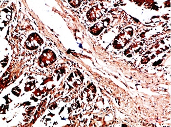 HLA-DQA1 rabbit pAb Antibody
