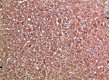 Haptoglobin rabbit pAb Antibody