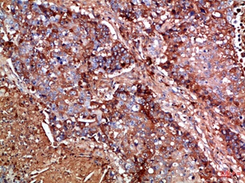 Haptoglobin rabbit pAb Antibody
