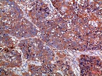 Haptoglobin rabbit pAb Antibody