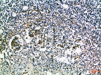 CD274 rabbit pAb Antibody