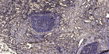 LIM and SH3 domain protein 1 rabbit pAb Antibody