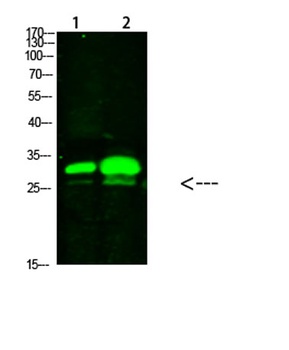 KCTD7 rabbit pAb Antibody