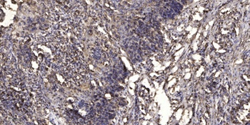 KCTD7 rabbit pAb Antibody