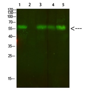 AVP Receptor V2 rabbit pAb Antibody