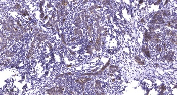 Integrin β7 rabbit pAb Antibody