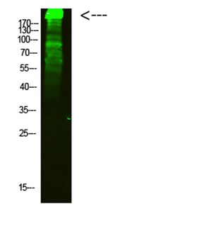 MYH6 rabbit pAb Antibody