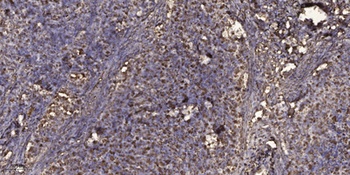 MYH6 rabbit pAb Antibody