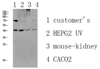 CCR5 rabbit pAb Antibody