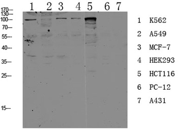 CDH17 rabbit pAb Antibody