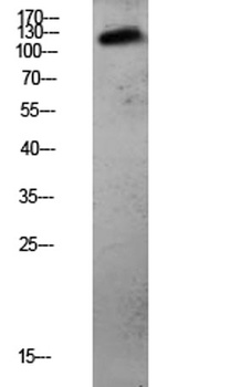 CDH3 rabbit pAb Antibody