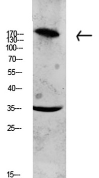 Collagen XI α1 rabbit pAb Antibody