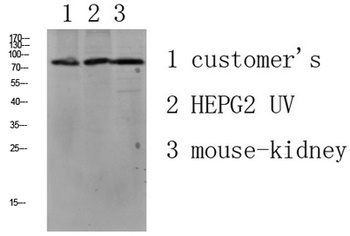 LSHR rabbit pAb Antibody