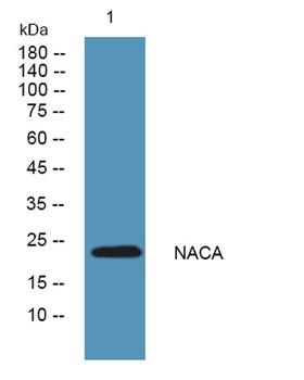 NACA rabbit pAb Antibody
