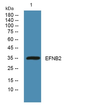 EFNB2 rabbit pAb Antibody