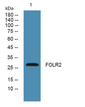 FOLR2 rabbit pAb Antibody