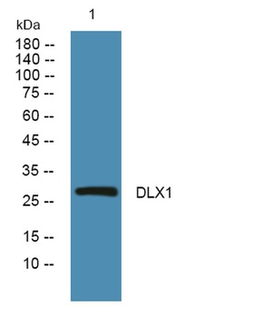 DLX1 rabbit pAb Antibody