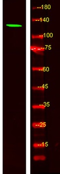 MYO1F rabbit pAb Antibody