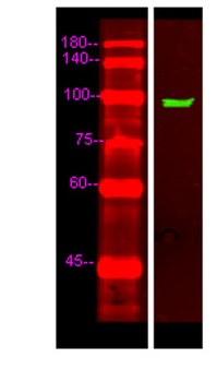 UNC5C rabbit pAb Antibody