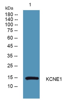 KCNE1 rabbit pAb Antibody
