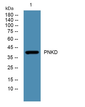 PNKD rabbit pAb Antibody