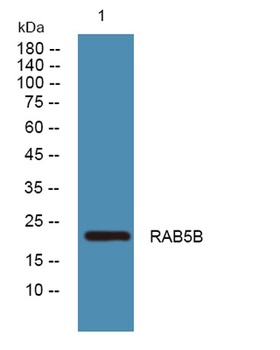RAB5B rabbit pAb Antibody