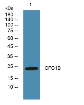 CFC1B rabbit pAb Antibody