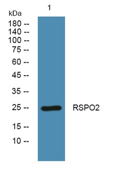 RSPO2 rabbit pAb Antibody