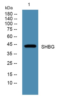 SHBG rabbit pAb Antibody