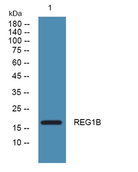 REG1B rabbit pAb Antibody