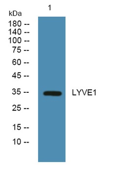 LYVE1 rabbit pAb Antibody