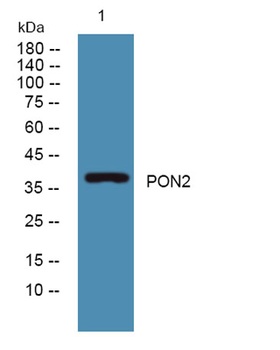 PON2 rabbit pAb Antibody