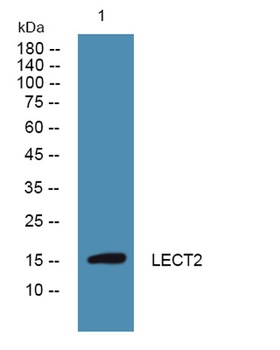 LECT2 rabbit pAb Antibody