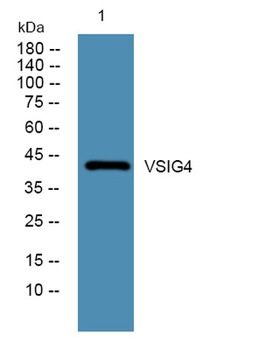 VSIG4 rabbit pAb Antibody