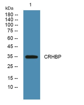 CRHBP rabbit pAb Antibody